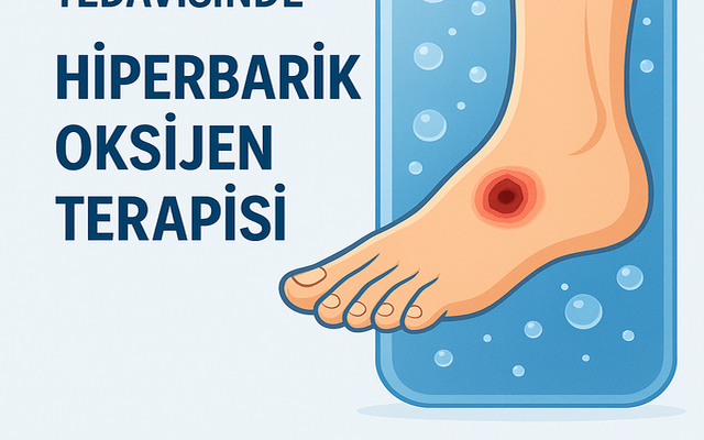 Oxygen Therapies in Diabetic Foot Treatment: HBOT and Topical Oxygen