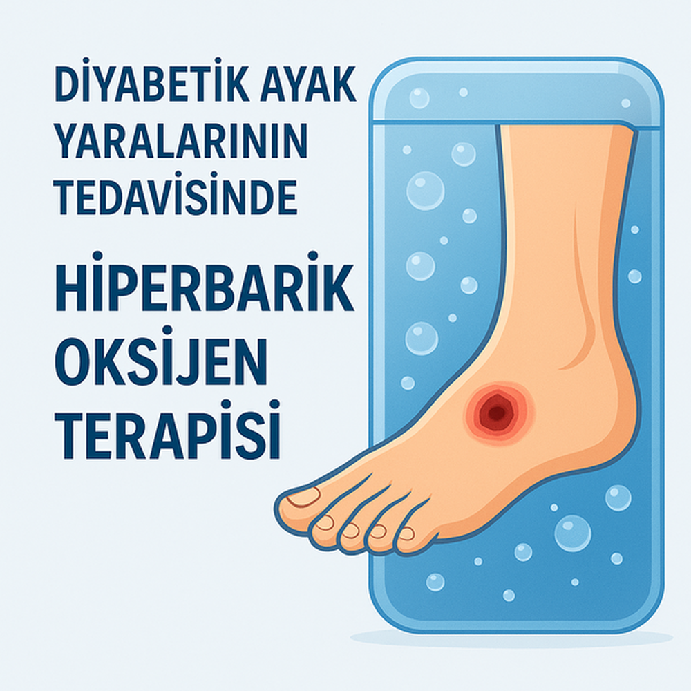 Oxygen Therapies in Diabetic Foot Treatment: HBOT and Topical Oxygen