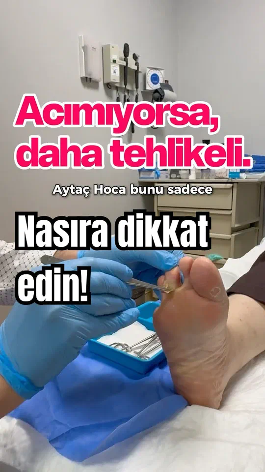Acımıyorsa, daha tehlikeli. #Nasır #DiyabetikAyak